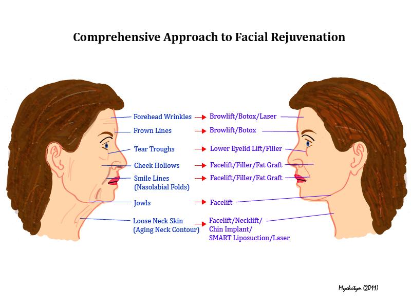 COMPREHENSIVE-FACE